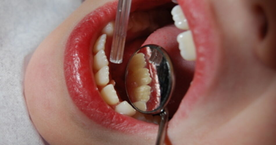Fakta og helsestatistikk om tannhelse fra FHI 2011