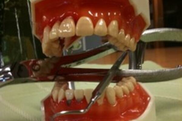 gap_ modell2_240x262