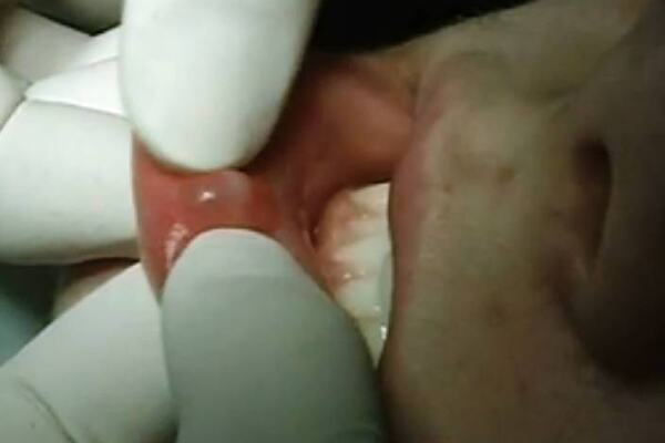 Youtube i utdanning av tannleger