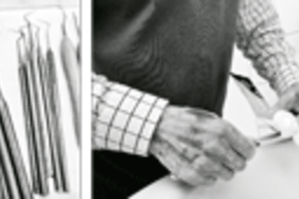 Tannhelse og livskvalitet hos personer etter hjerneslag